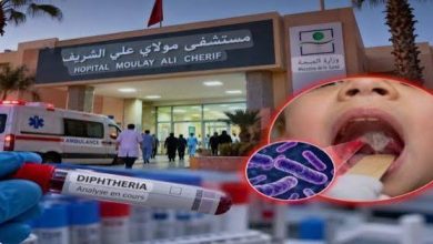 السعيدية.. تدابير استباقية وعاجلة عقب تسجيل حالة وفاة بمرض الدفتيريا