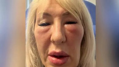 جريمة ماربيا: خلاف حول عملية تجميلية يكشف تفاصيل مثيرة حول مقتل جراح شهير