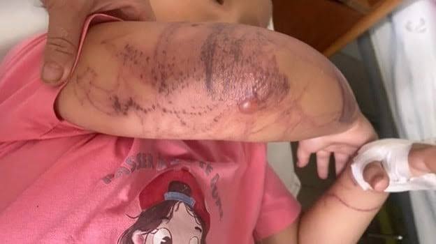 فاجعة بتازة.. عضة كلب ضال تضع حداً ليوماً طفل يبلغ من العمر 14 سنة