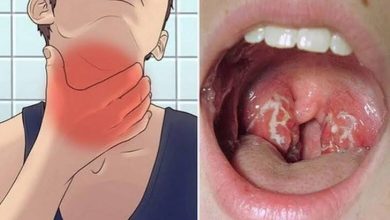 جهة الداخلة.. رصد حالتين مشتبه في إصابتهما بالدفتيريا وترقب النتائج المخبرية