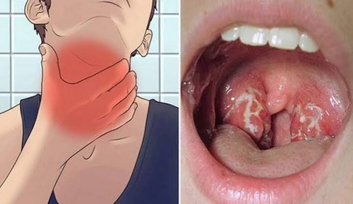 جهة الداخلة.. رصد حالتين مشتبه في إصابتهما بالدفتيريا وترقب النتائج المخبرية
