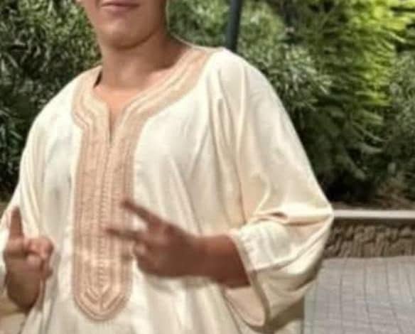 فاجعة في تاوريرت: واقعة عض الطفل لكلب مسعور تسلط الضوء على مخاطر داء الكلب